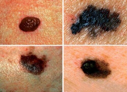 4 Signs Your Body Is Telling You Something's Wrong
