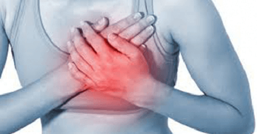 Broken Heart Syndrome Cardiomyopathy In Women