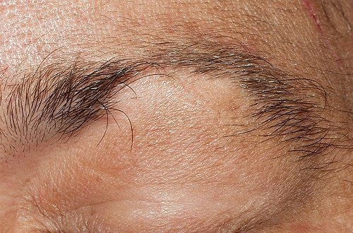 Natural Remedies for Hair Loss: Eyebrows and Eyelashes