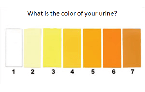 Urine color chart to determine urine color