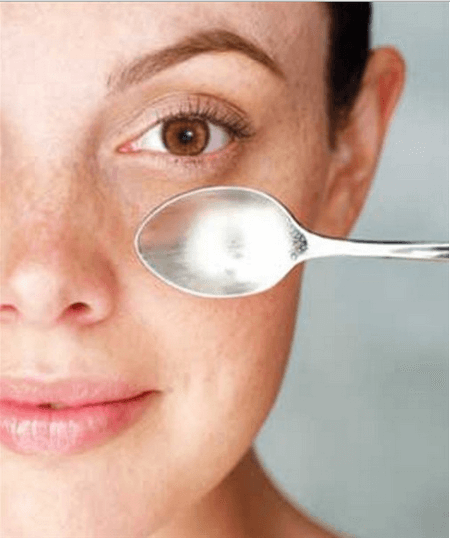 Woman doing the cold spoon treatment to reduce dark circles