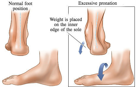 inner pronation