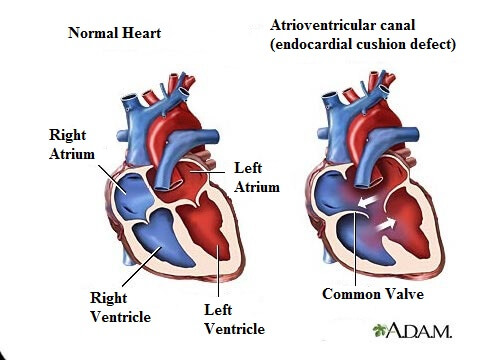 7 Heart Murmur Symptoms You Should Know Step To Health