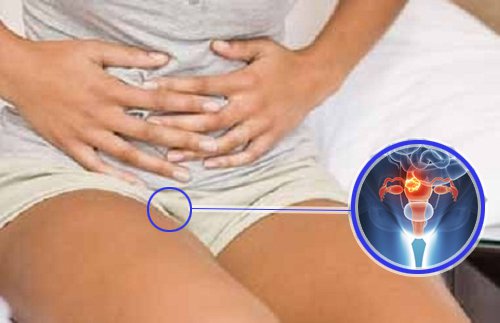Pain from uterine fibroids