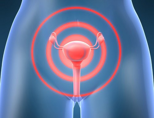 What Are Uterine Fibroids and How Are They Treated?