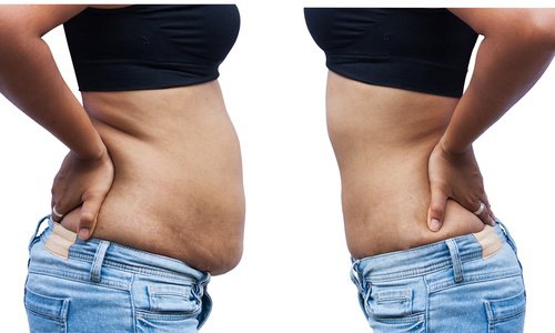 Belly Fat: 8 Possible Reasons Why You Accumulate It