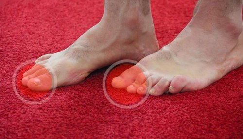 6 Ways to Reduce Uric Acid Levels
