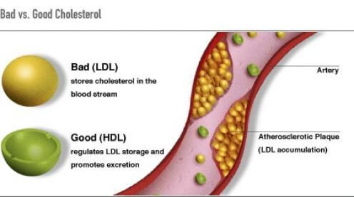 How eggplant water can help improve bad cholesterol
