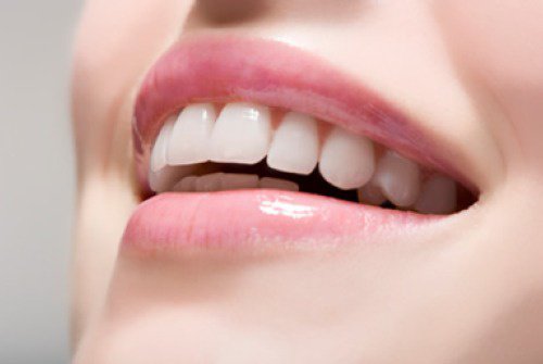 perfect-teeth