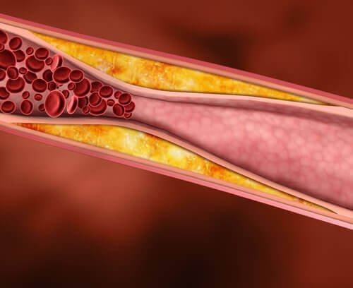 Digital image of blood vessel natural remedies with avocado