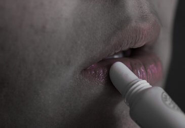 A woman with chapped lips.