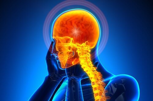 Aneurysms can cause headaches