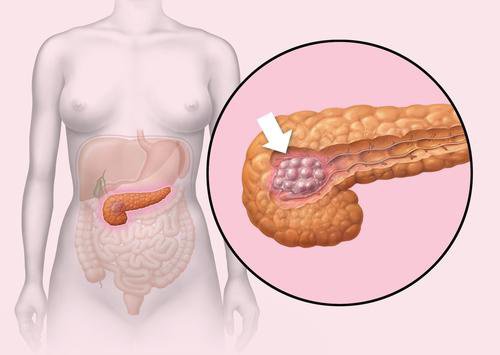 Tips on Improving the Health of Your Pancreas