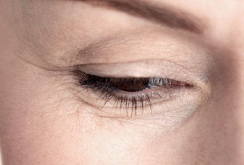 Close up of woman's eye with wrinkles natural remedies with avocado