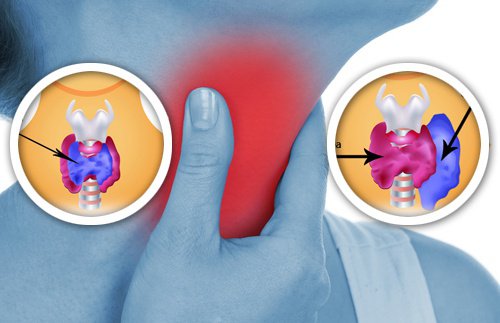 8 Household Products that Can Affect Your Thyroid