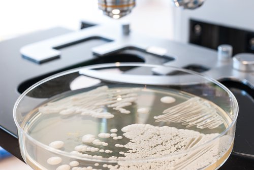 A test for candida yeast infection