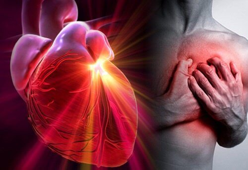 How to Reduce the Risk of Heart Attack or Stroke How to Reduce the Risk of Heart Attack or Stroke