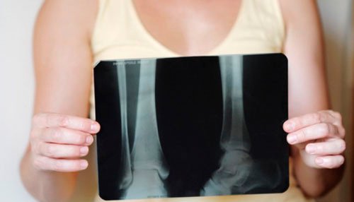 Woman holding an x-ray