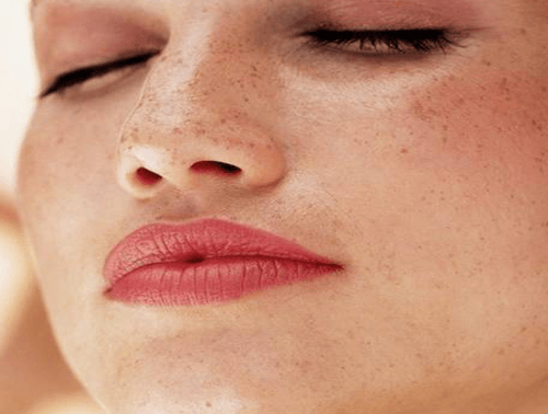 freckles face