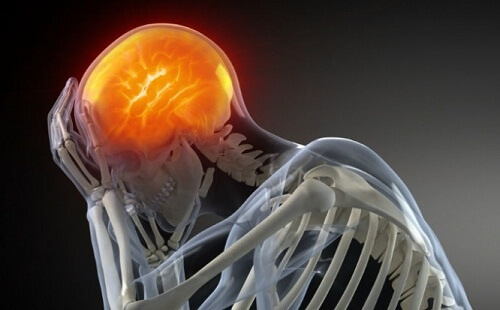 Headache