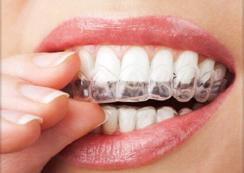 4 Techniques to Stop Grinding Your Teeth
