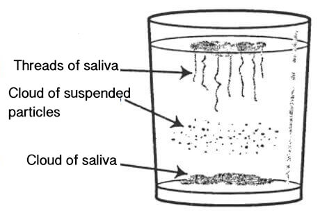 How to Test for Candida at Home