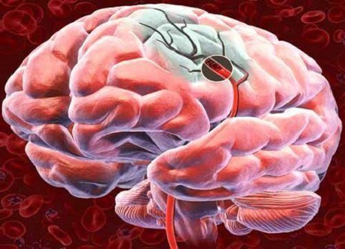 Five Ways to Increase Blood Flow to Your Brain