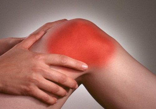 arthritis
