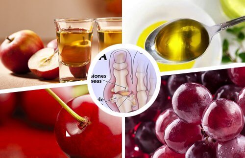 Natural Remedies gout-remedies