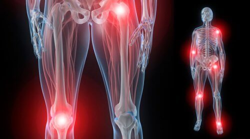 Causes of Joint Pain at Night and How to Relieve It