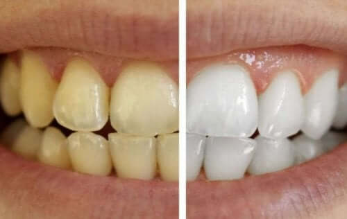 Care For Your Teeth with 100% Natural Products