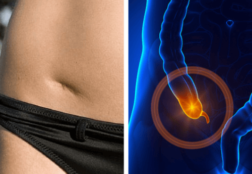 The Warning Signs of Appendicitis