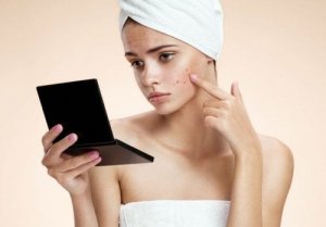 6 Home Remedies for Blackheads and Pimples