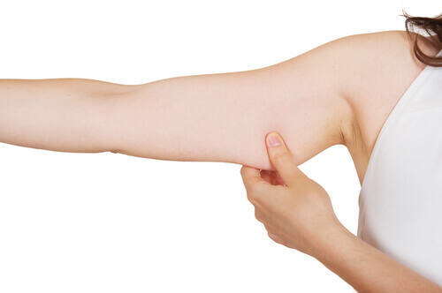 A lady with sagging arms.