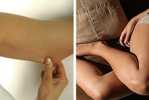 Firm and Tone Your Arms and Legs