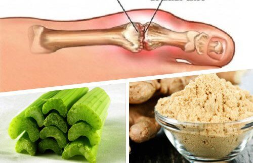 Eliminate Uric Acid Crystals with Ginger and Celery