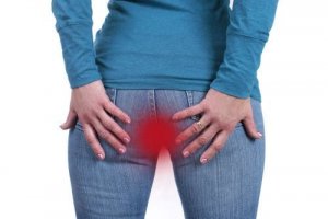 How to Naturally Treat Hemorrhoids