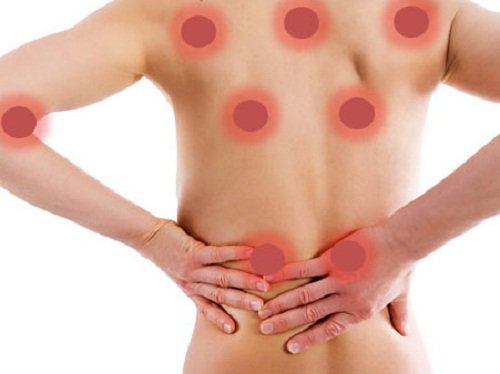 Spots where back pain might occur.