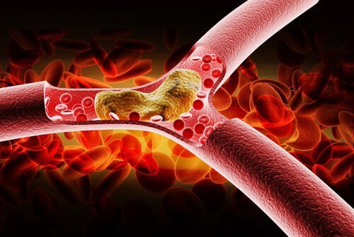 A close up of an artery.