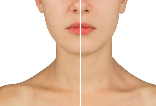 hydrogen peroxide remedies