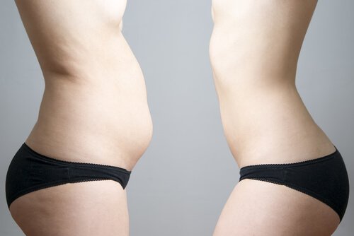 A picture of a women with a bloated stomach and then a flat one.
