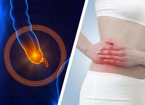 A diagram of where appendicitis occurs.