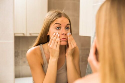 A woman with under eye circles.