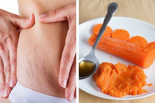 Carrot Treatment That May Help Reduce Stretch Marks