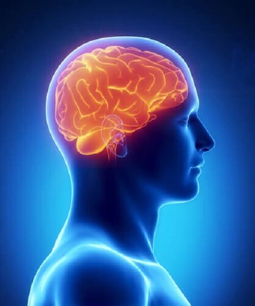 Brain with dementia caused by sleep deprivation