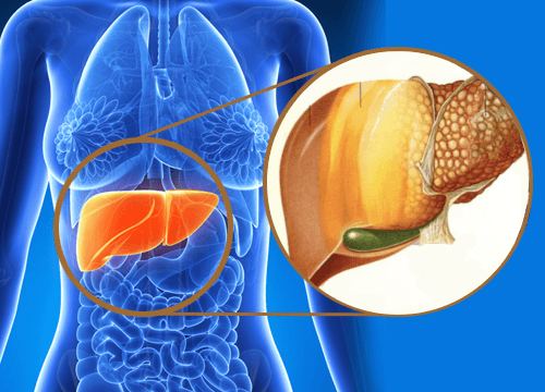 How Coconut Oil Fights Fatty Liver Disease