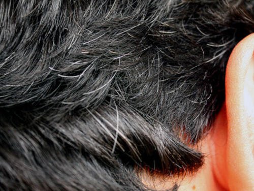 6 Home Remedies for Early Gray Hair