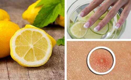 6 Amazing Lemon Beauty Benefits