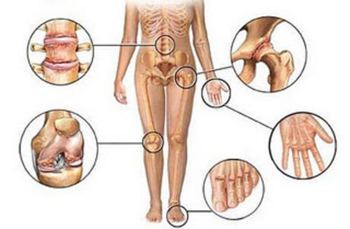 Different joints in the body