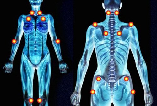 Pain spots in the body